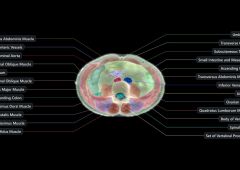 Midjourney Scanner coupe